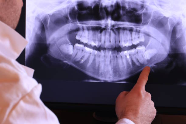 Best Broken or Chipped Tooth Repair in Northport, NY